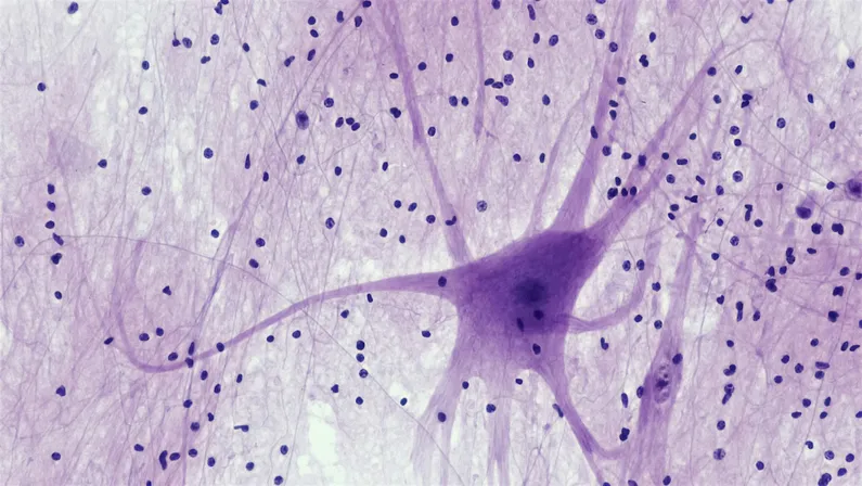 Motor Neuron